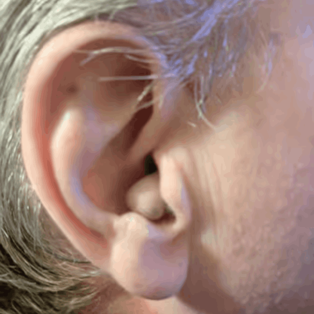 Audien Hearing Aids 5